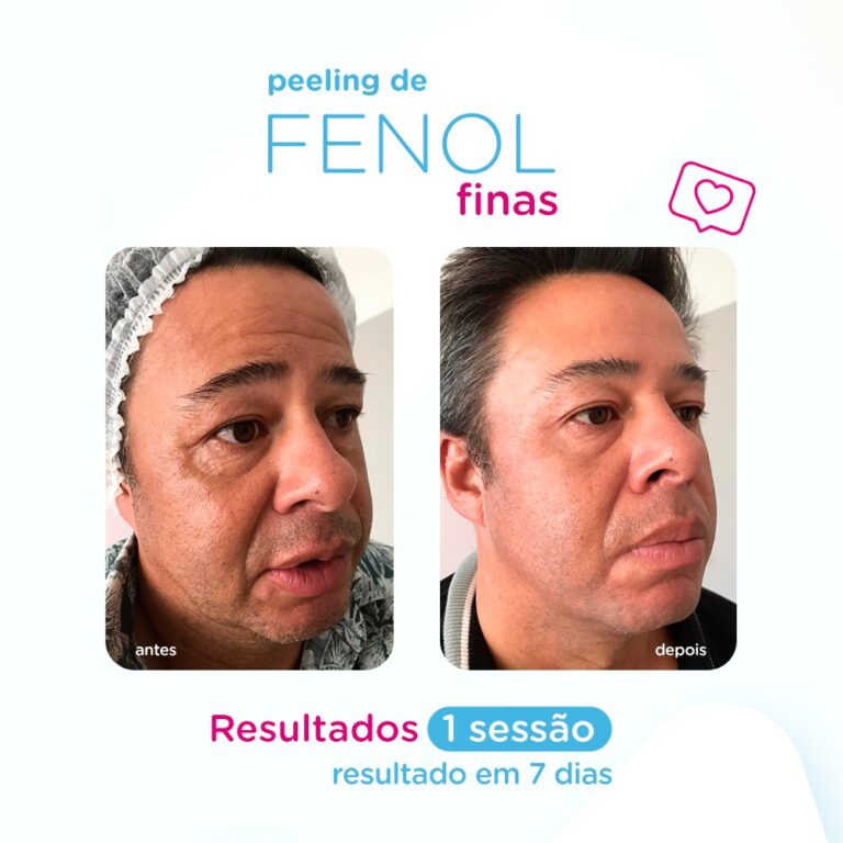 PeelingFinas - Perfil